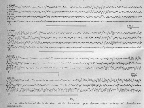 Una figura dall'articolo di Moruzzi e Magoun del 1949